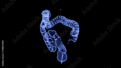 CT colonography , This imaging technique is often employed for colorectal cancer screening, providing detailed images of the colon's interior 3D rendering. photo