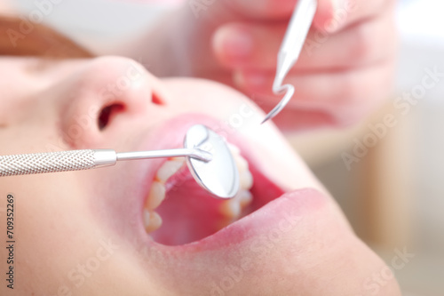 歯科治療を受ける女性 photo