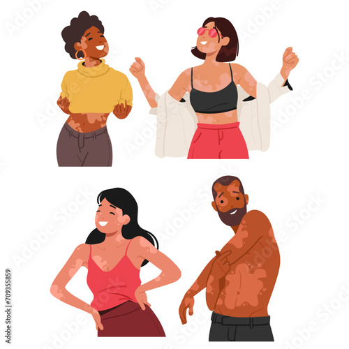 Joyful People Proudly Embracing Their Unique Beauty, Confidently Displaying Vitiligo Patches. Radiating Self-love