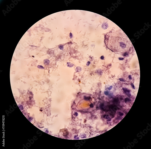 Trichomonas vaginalis is an anaerobic, flagellated protozoan parasite and the causative agent of trichomoniasis. photo