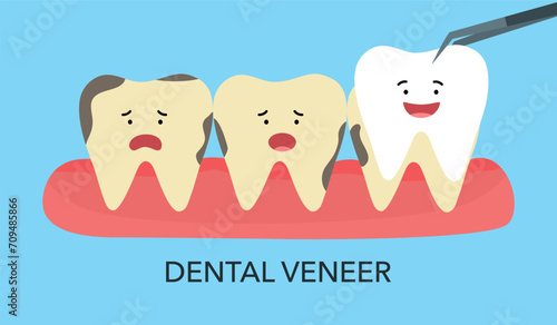 Smiling and upset teeth cartoon character on gum and veneer. Funny teeth dental restoration. Putting new veneer on discolored tooth.
