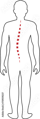 Spine Body Posture Type