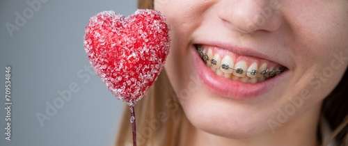 Cute woman with braces on her teeth holds a candy in the form of a heart on white background. Widescreen. 