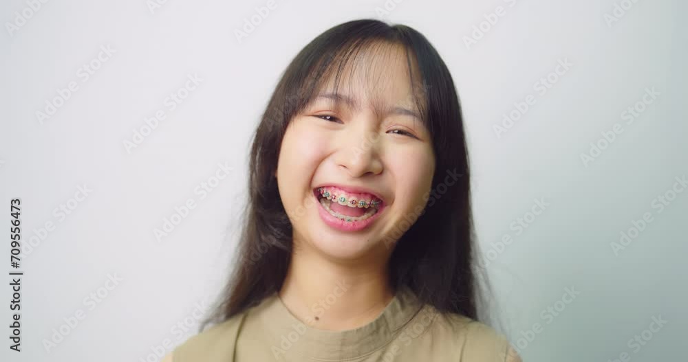 Happy beautiful asian girl with braces. She looking to camera with attractive smiling at white background. Happy beautiful asian girl with braces. She looking to camera with attractive smiling at white background.