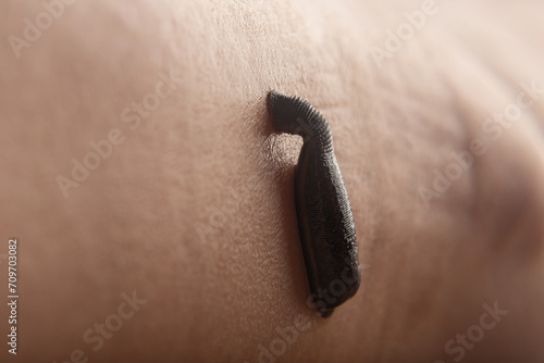 Photos leech