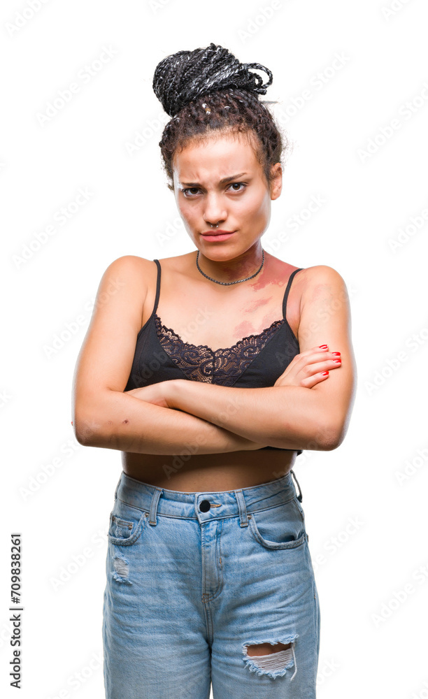 Young braided hair african american with pigmentation blemish birth mark over isolated background skeptic and nervous, disapproving expression on face with crossed arms. Negative person. Young braided hair african american with pigmentation blemish birth mark over isolated background skeptic and nervous, disapproving expression on face with crossed arms. Negative person.