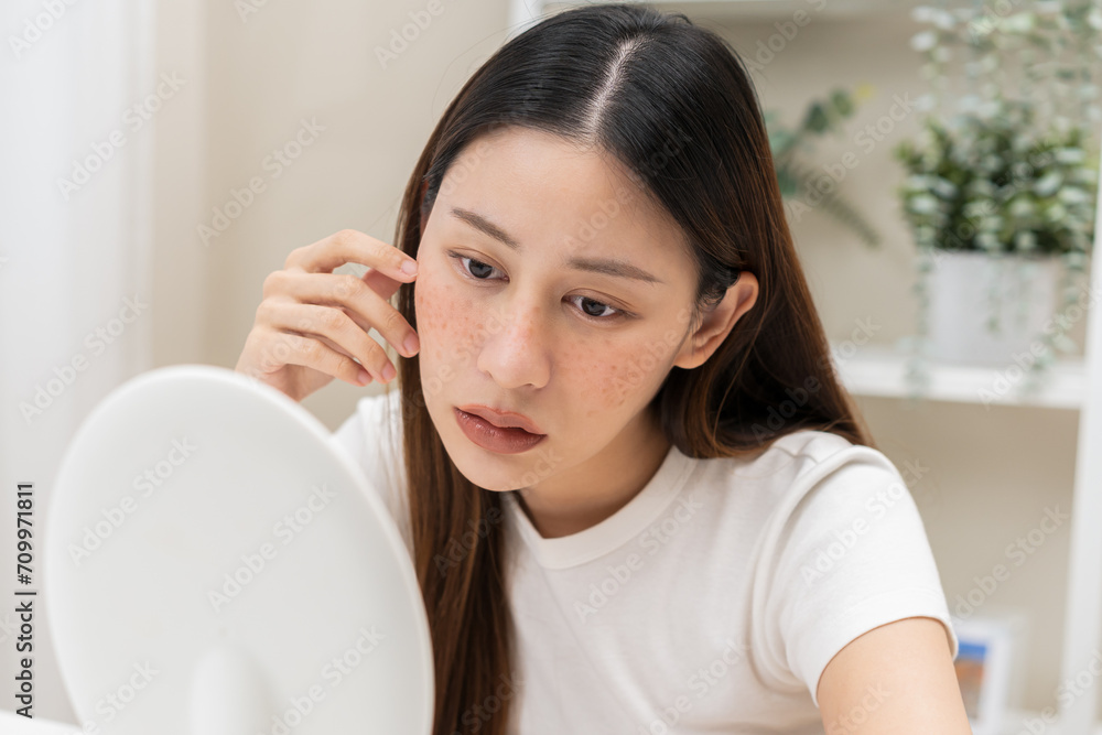 Dermatology, expression face worry asian young woman looking mirror