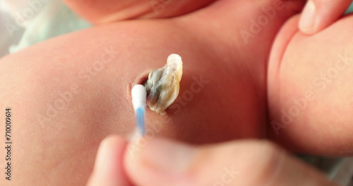 Photos Mother cleaning newborn baby umbilical cord after birth, first week of infant li