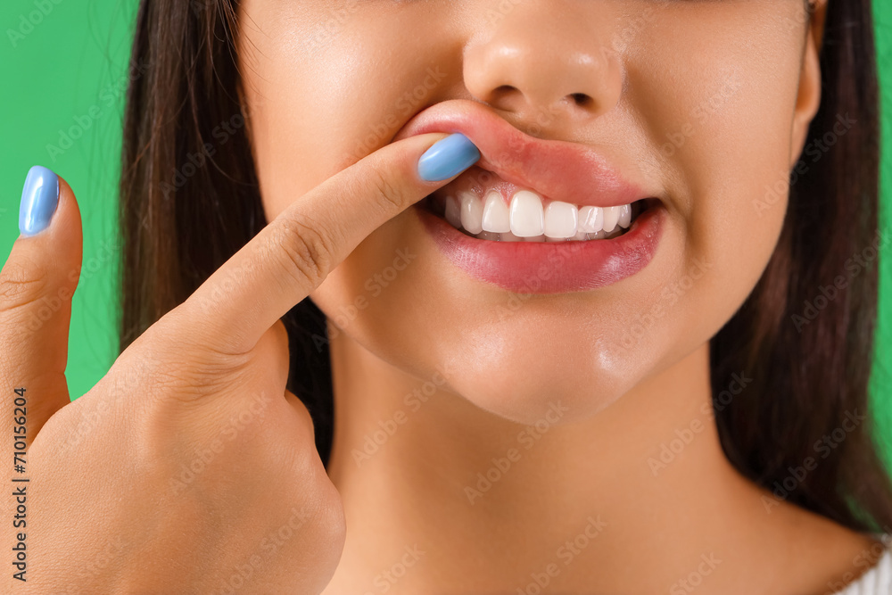 Young woman with healthy teeth on green background, closeup Young woman with healthy teeth on green background, closeup