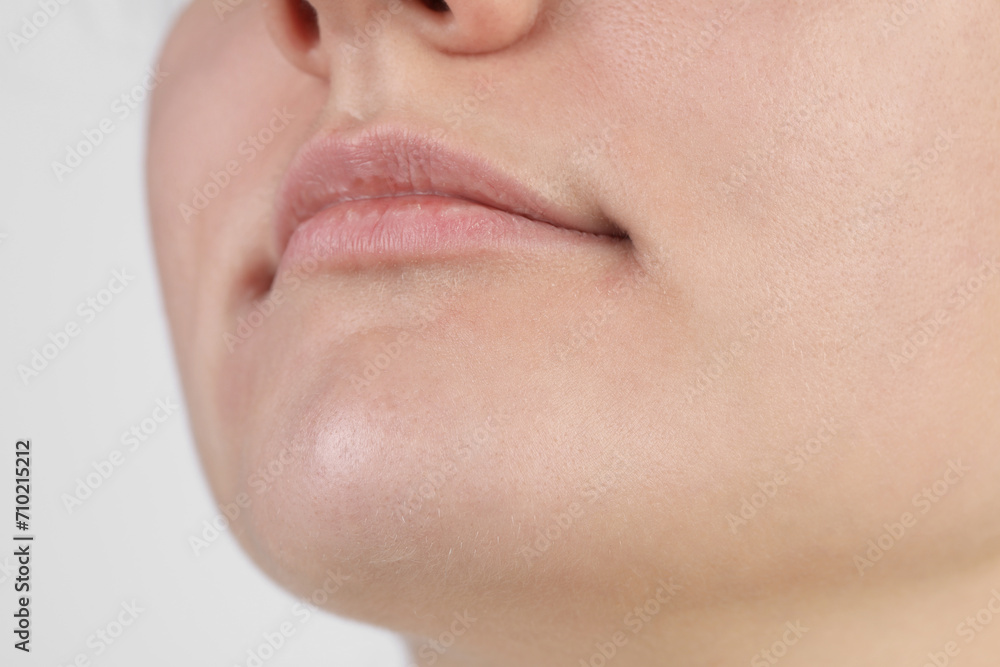 Woman with dry skin on white background, closeup view Woman with dry skin on white background, closeup view