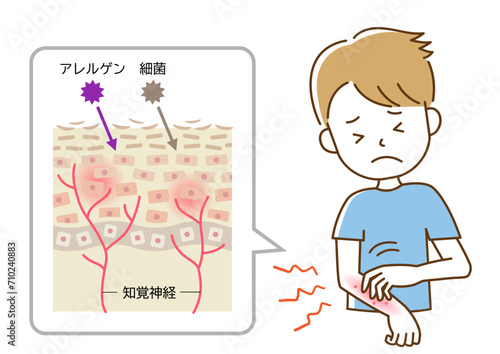 かゆみ　手を掻く男性  肌細胞