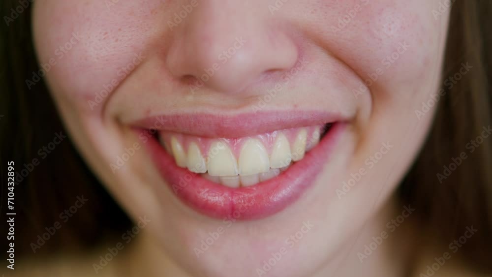 Diverse people smiling showing teeth expressing positive emotions. Close-up Of different smiles of Multi Ethnic Women. Diversity Concept. Diverse people smiling showing teeth expressing positive emotions. Close-up Of different smiles of Multi Ethnic Women. Diversity Concept.