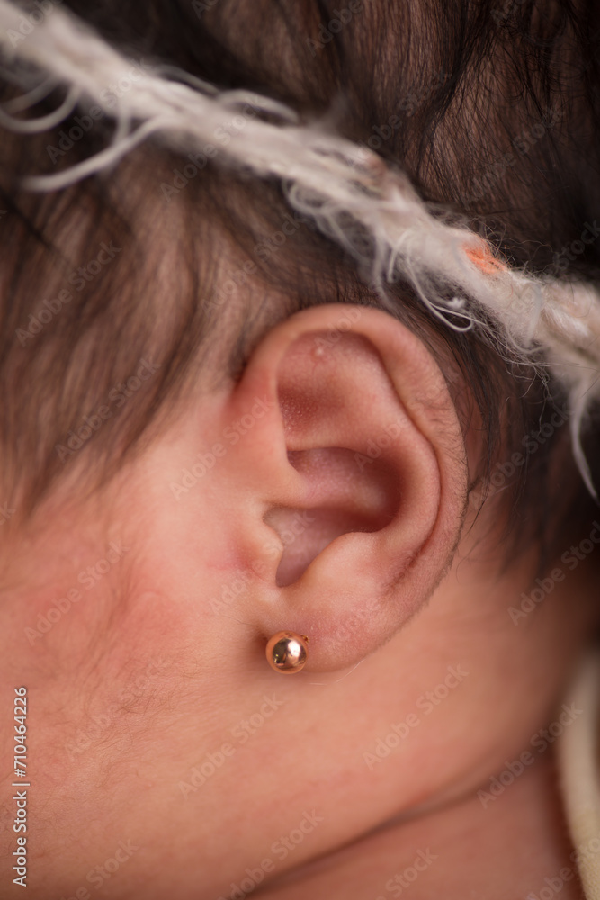 Little newborn baby earlobe earring ear preauricular appendix listen Little newborn baby earlobe earring ear preauricular appendix listen