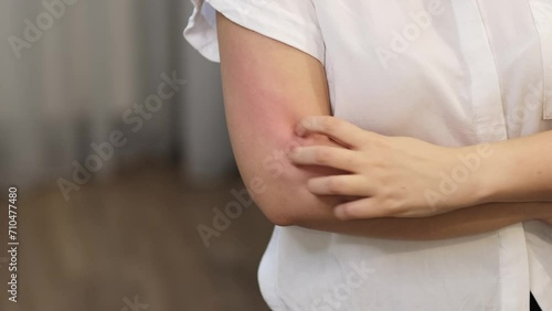 Scratching her arm, the woman's gesture hints at the invisible link between psychological states and physical symptoms.
