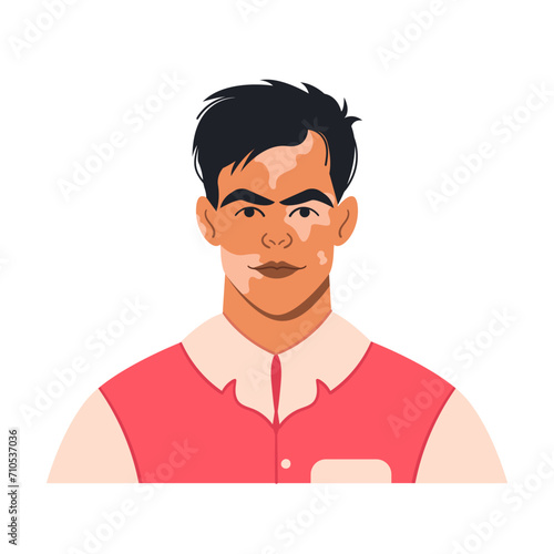 Portrait of a young man with vitiligo. A full-face avatar of a male character in a flat style for social networks. Bright vector illustration