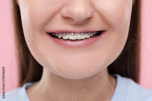 Smiling woman with dental braces on pink background  closeup