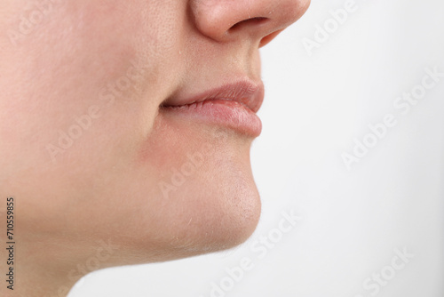 Woman with dry skin on white background, closeup view. Space for text