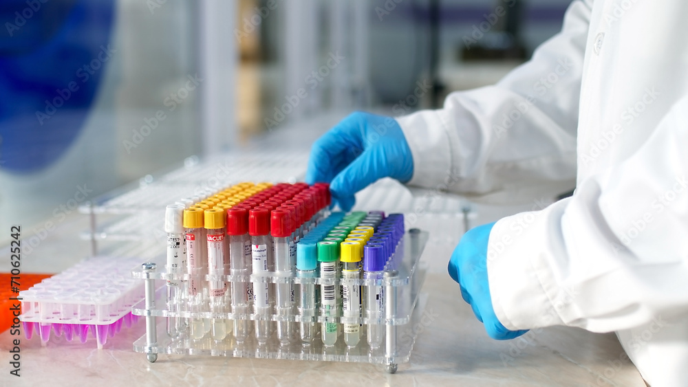 Modern loborothyria. The scientist examines the test tubes and takes notes. Organized test tubes with scientific samples and substances in them, intended for scientific research. Modern loborothyria. The scientist examines the test tubes and takes notes. Organized test tubes with scientific samples and substances in them, intended for scientific research.