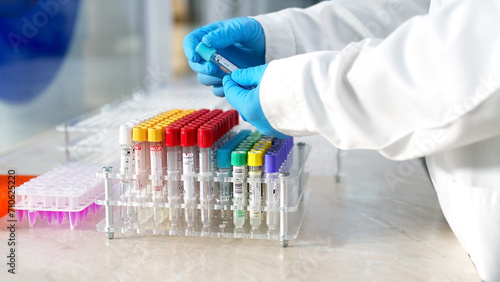 Modern loborothyria. The scientist examines the test tubes and takes notes. Organized test tubes with scientific samples and substances in them, intended for scientific research.