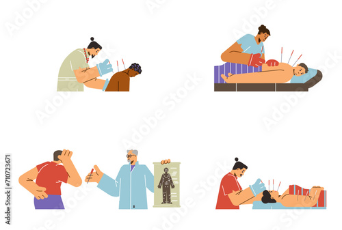 Acupuncture treatment, therapy vector illustrations set, acupuncturist inserts needles in the patient's face or back