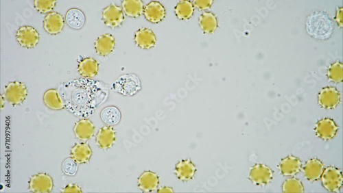 White Blood cell neutralising pathogen causing infection by phagocytosis. 