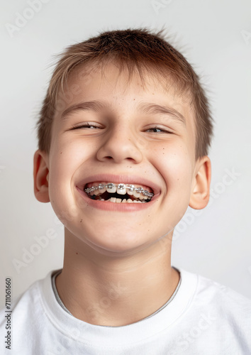 little smiling boy with metal braces on her teeth, bite correction, orthodontist, health, medicine, dentistry, oral cavity, straight, white, mouth, person, people, treatment, kid, child, children