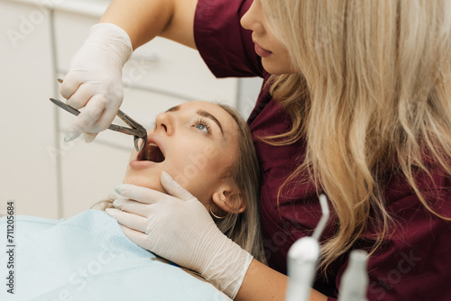 Wallpaper Mural Dentist using surgical pliers to remove a decaying tooth in clinic Torontodigital.ca