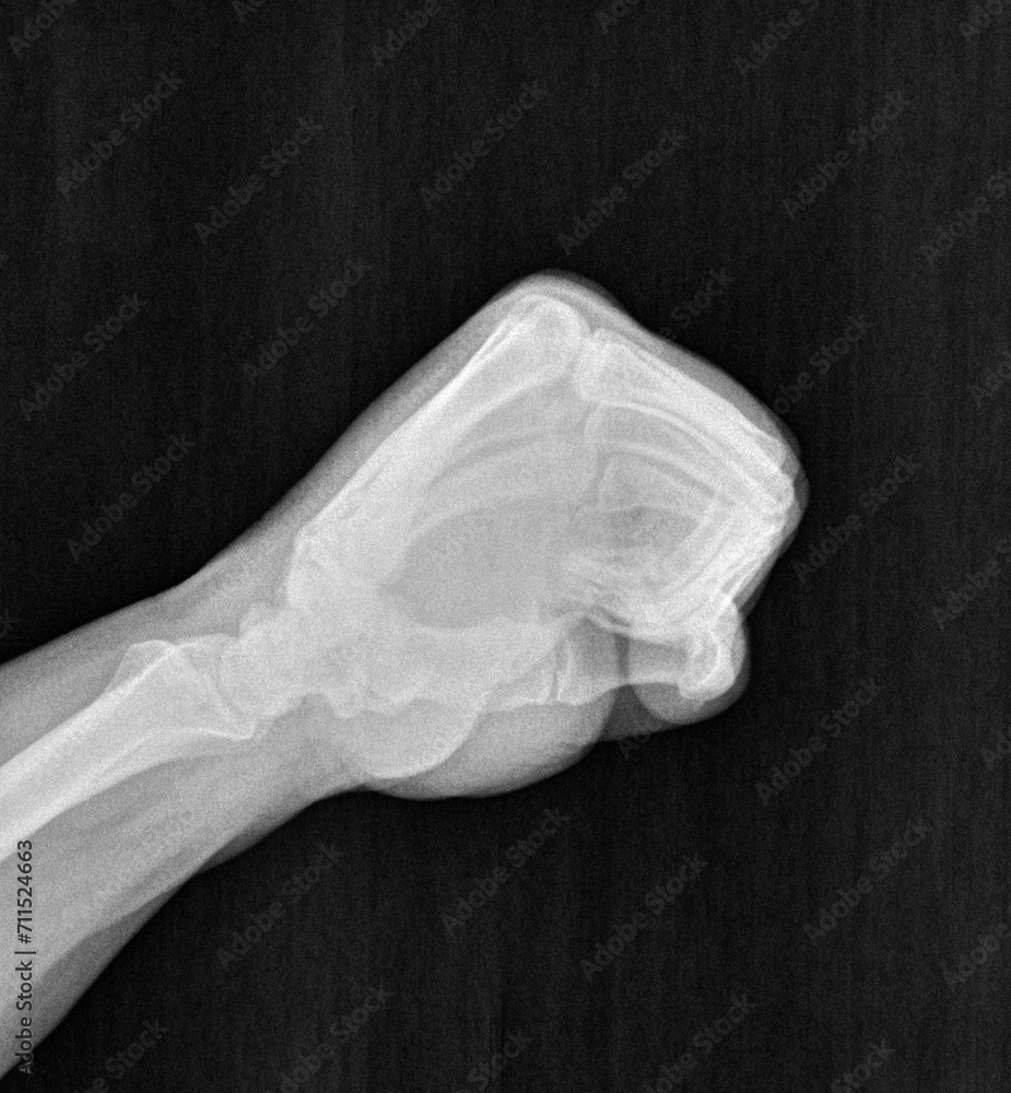 Film xray xray or radiograph of a hand and fingers in gestural