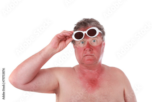 Konstfotografi Sunburned man lifting sunglasses showing tan lines