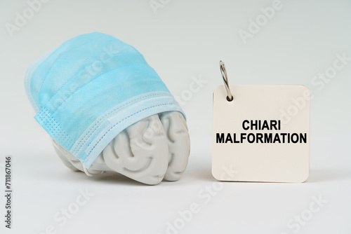 On a white surface next to the brain there is a notepad with the inscription - Chiari malformation photo