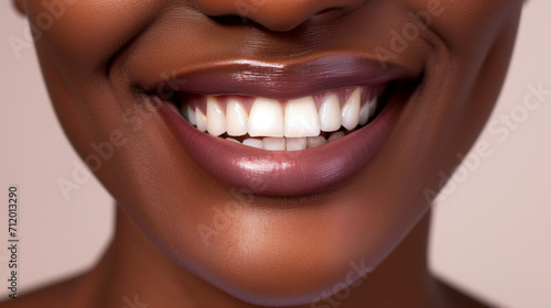 close-up of happy woman with perfect teeth. dental care concept