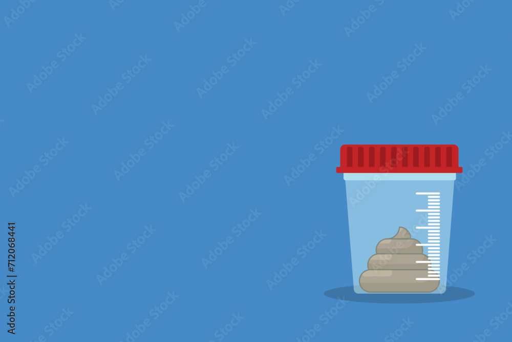 Stool analysis. Stool test. Medical research report clipboard with medical sample in a glass tube. Stool analysis. Stool test. Medical research report clipboard with medical sample in a glass tube.