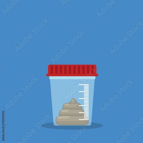 Stool analysis. Stool test. Medical research report clipboard with medical sample in a glass tube.	