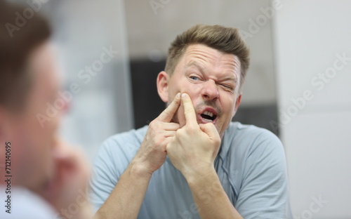 Portrait of man squeeze and get rid of pimple on face looking in mirror. Male take care of skin, facial procedure, undesirable skin rash. Wellness concept photo