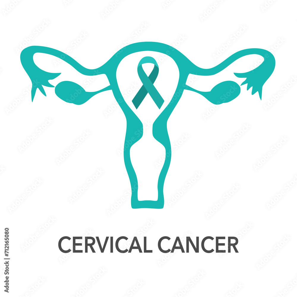 Cervical Cancer Awareness Month vector. Cervical cancer awareness ribbon and human uterus. Female reproductive health. Cervical Cancer Awareness Month vector. Cervical cancer awareness ribbon and human uterus. Female reproductive health.