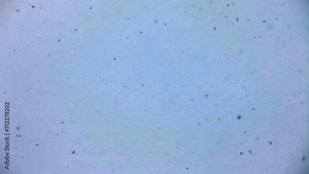 living cell under a microscope, chaos, continuous movement, viruses, abstract background living cell under a microscope, chaos, continuous movement, viruses, abstract background
