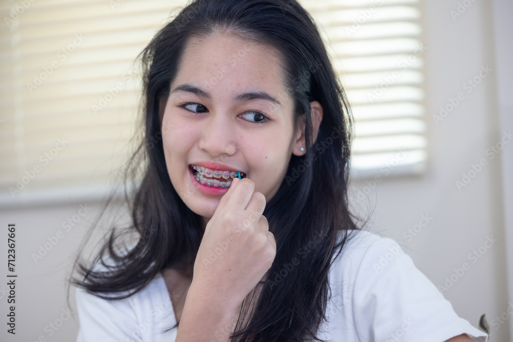 Happy Asian Teenager with Colorful Braces Smiling. Happy Asian Teenager with Colorful Braces Smiling.