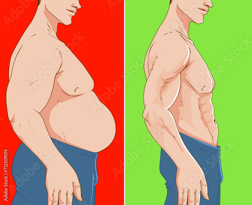 A man's body with belly fat. Before, after. Healthcare illustration. Vector illustration. 