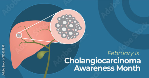 Cholangiocarcinoma Awareness Month. Bile duct cancer campaign banner.