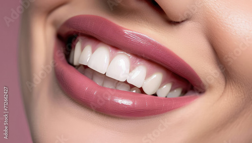 primer plano de la boca y labios rosas de una mujer sonriendo mostrando una dentadura perfecta photo