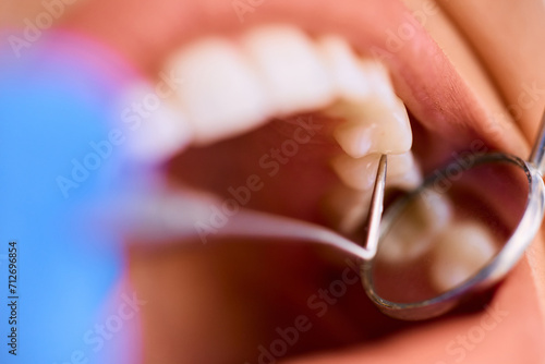 Close up of woman during dental procedure at dentist s office.