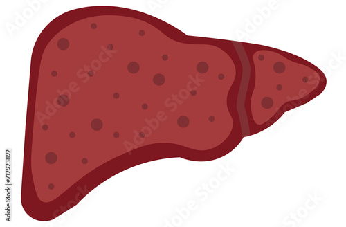 liver, cirrhosis disease. Human liver organ anatomy vector illustration on white background.Stage Of liver Disease Concept,Unhealthy Liver,Cirrhosis Medical Education,sad,red,yellow