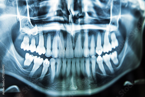 dental x ray image