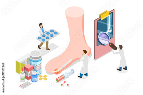 Foto 3D Isometric Flat  Conceptual Illustration of Gout Treatment, Medical Appointmen