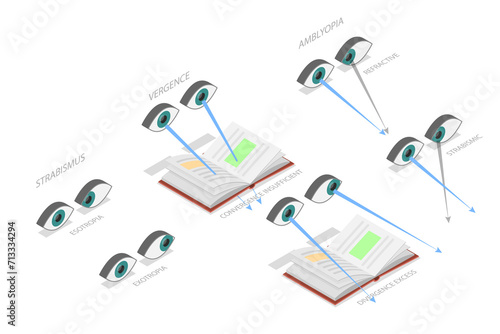 3D Isometric Flat  Conceptual Illustration of Binocular Vision Disorders, Medical Sight Health Problems photo