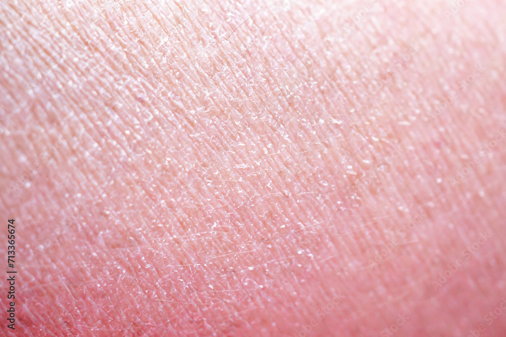 dry and dehydrated human skin texture background