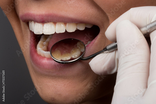 dentist checking patient's teeth