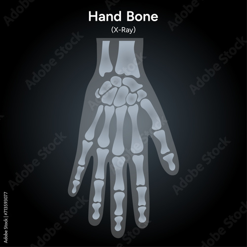 Human hand bone xray