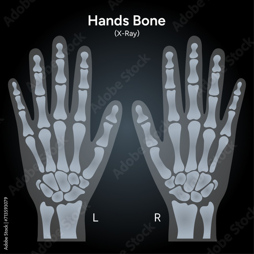Human hands bone xray