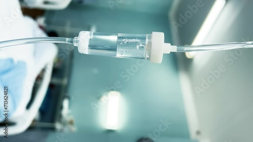 Drip chamber in an IV hanging on a medical infusion stand against the background of blurred medical beds in a clinic ward. Intravenous injections, medical care in a hospital. Vertical video photo